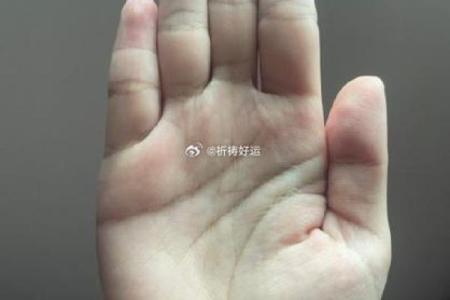 胳膊长黑毛?你的命运密码隐藏在这里,如何解锁人生新局