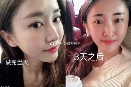 如何改变命运：颈纹与八字的神秘联系